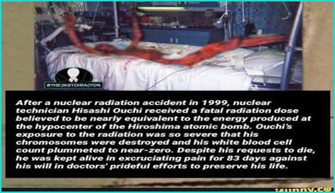**The Remarkable Journey Of Hisachi Ouchi After Radiation**